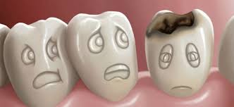 TOTUL DESPRE VACCINUL ANTICARIE