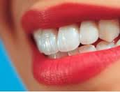 Estetica dentara prin igienizarea dentara