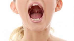 Simptomele cancerului oral