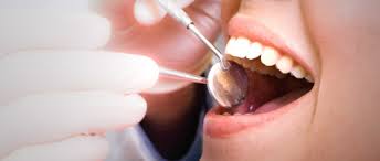 Sinuzita de cauza dentara- maxilara odontogena